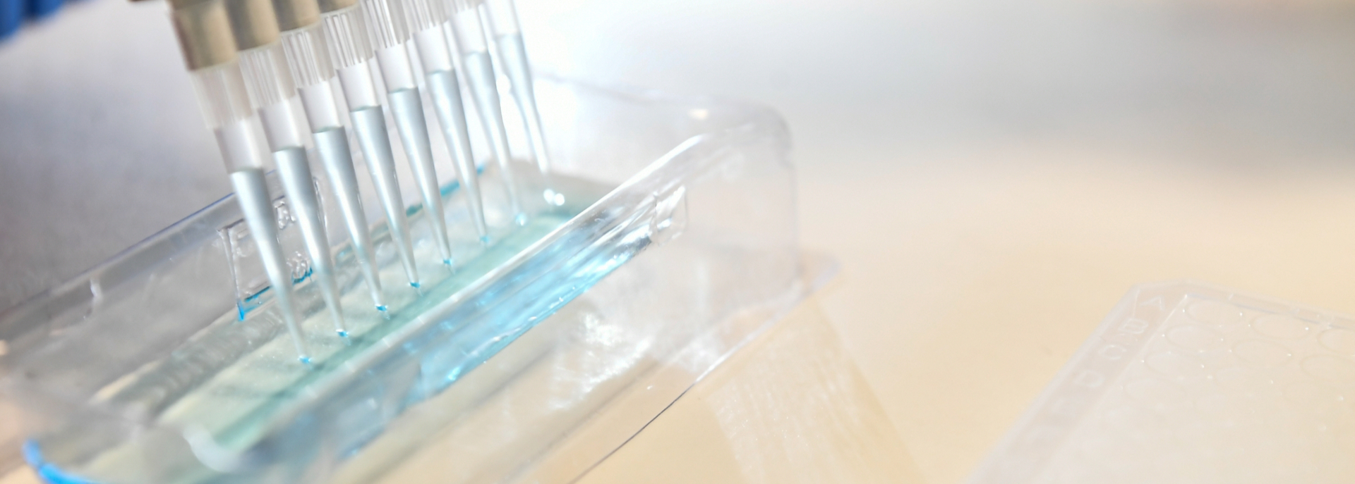 IRCCS Fatebenefratelli: schizofrenia e geni