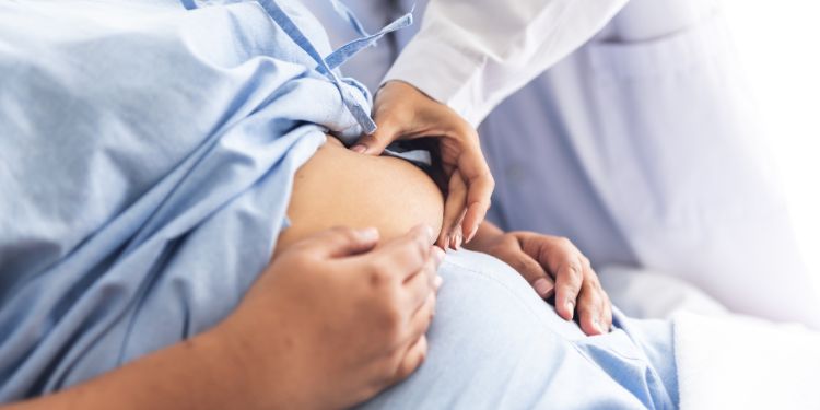 Obesità fattore rischio sviluppo tumore al colon