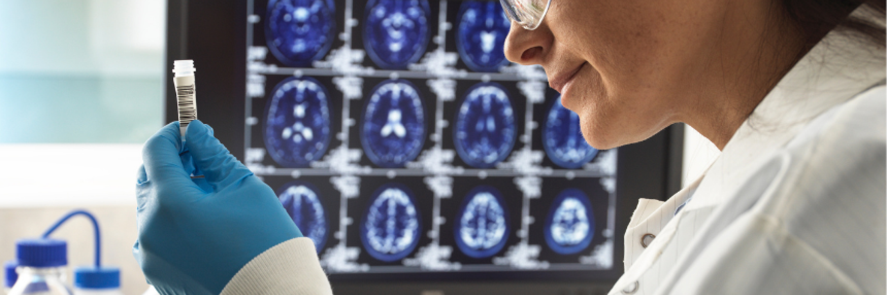 Non%20solo%20Alzheimer%20cure%20personalizzate%20e%20nuove%20prospettive%20per%20le%20demenze.png