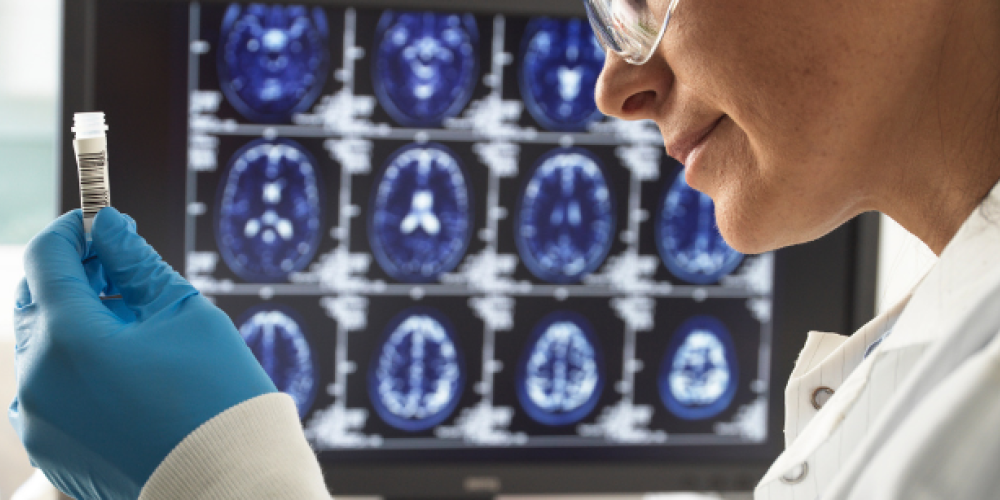 Non%20solo%20Alzheimer%20cure%20personalizzate%20e%20nuove%20prospettive%20per%20le%20demenze.png